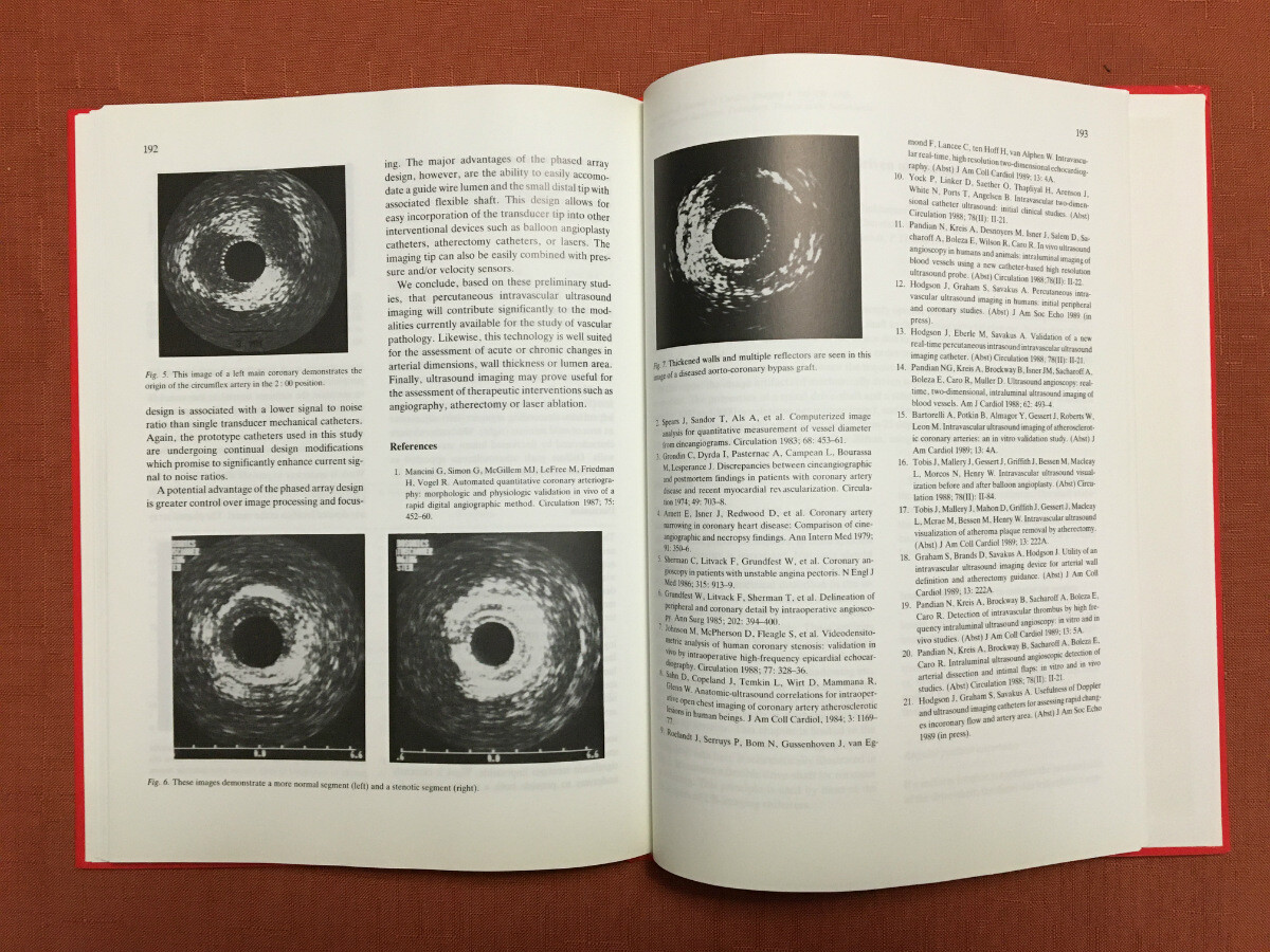 Intravascular Ultrasound – Edited by Bom & Roelandt -1989 – HB -Techniques, etc.