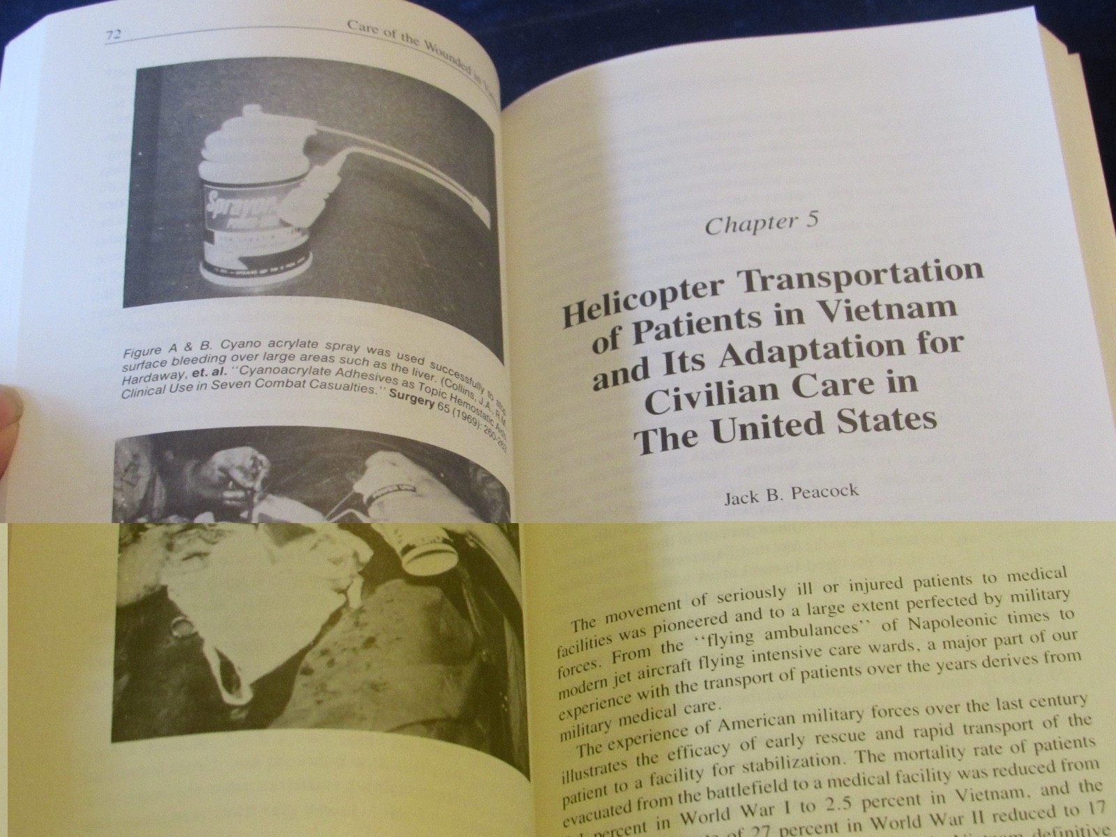 Care Of The Wounded In Vietnam (War) Robert Hardaway 1988 Softcover Book J11